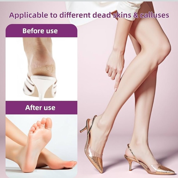 New in box - Amazon - Electric Foot File - Picture 7 of 7